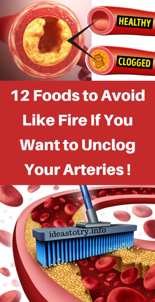 12 Foods to Avoid Like Fire If You Want to Unclog Your Arteries